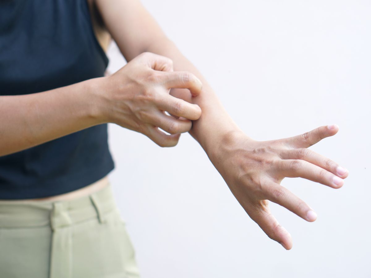 Stock image showing a hand scratching an arm's skin, obviously irritated and/or dry